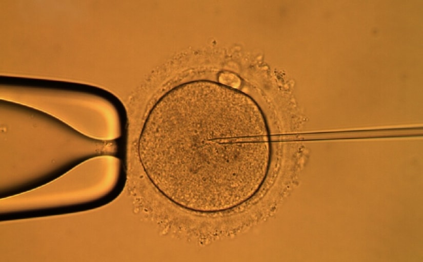 Intrasitoplazmik Sperm Enjeksiyonu (ICSI)